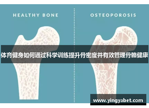 体育健身如何通过科学训练提升骨密度并有效管理骨骼健康